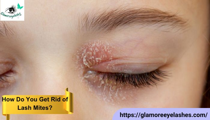 How Do You Get Rid of Lash Mites