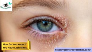 How Do You Know If You Have Lash Mites